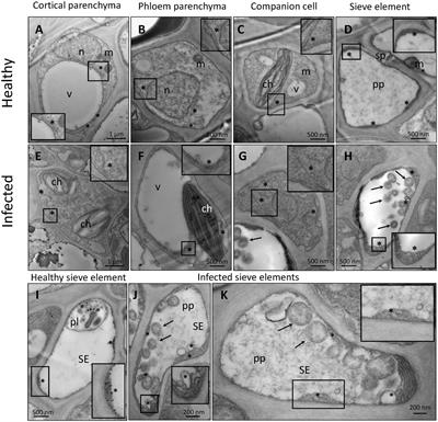 The sieve-element endoplasmic reticulum: A focal point of phytoplasma-host plant interaction?